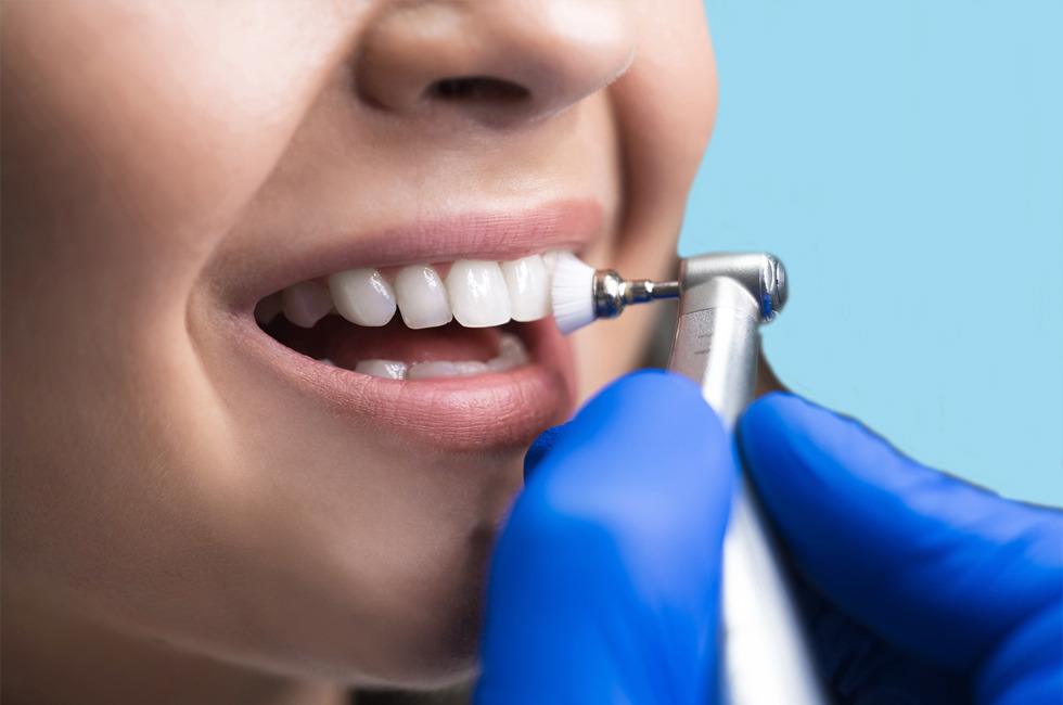 dental Cleaning