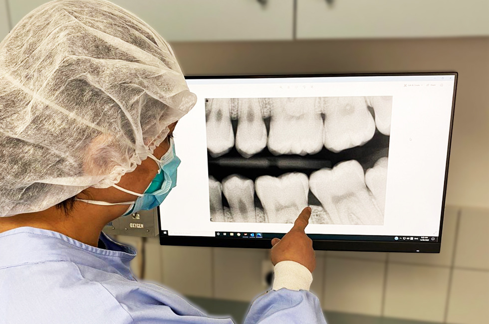 dental x rays