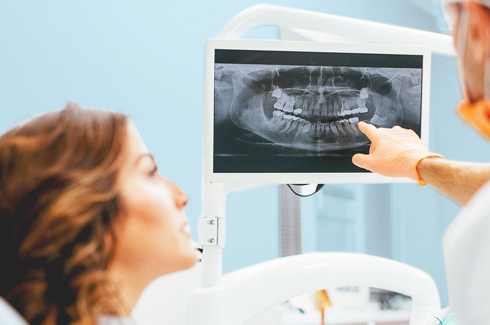 dental x rays