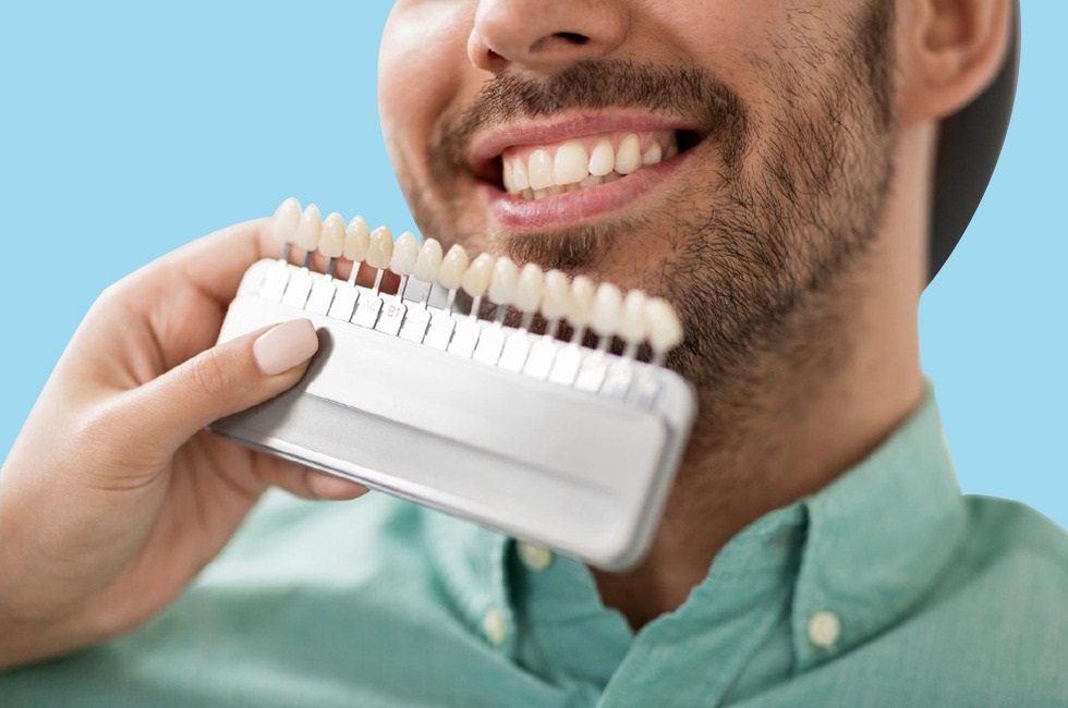Porcelain and Composite Veneers